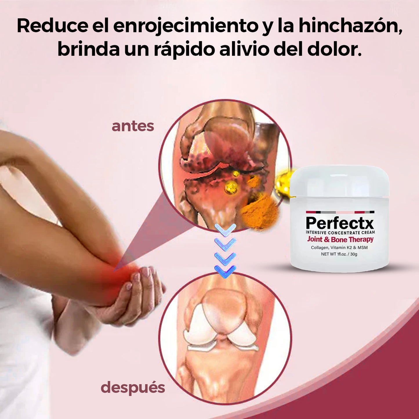 PerfectX™ – Elimine el dolor articular sin cirugía
